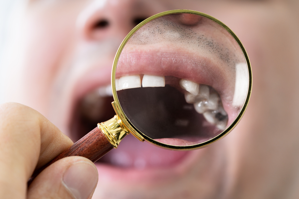 dentist examining missing tooth